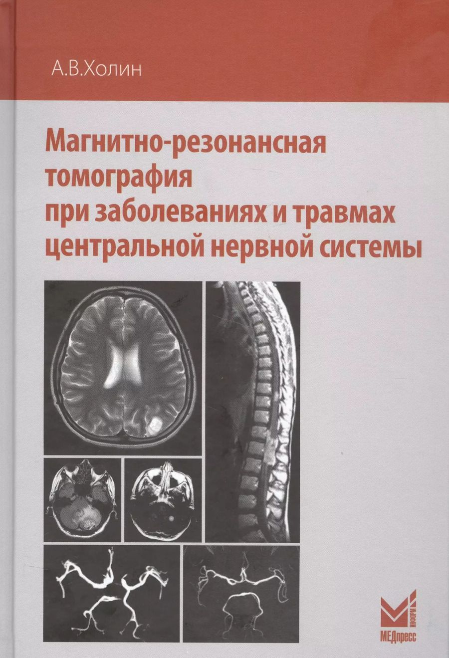 Обложка книги "Александр Холин: Магнитно-резонансная томография при заболеваниях и травмах центральной нервной системы"