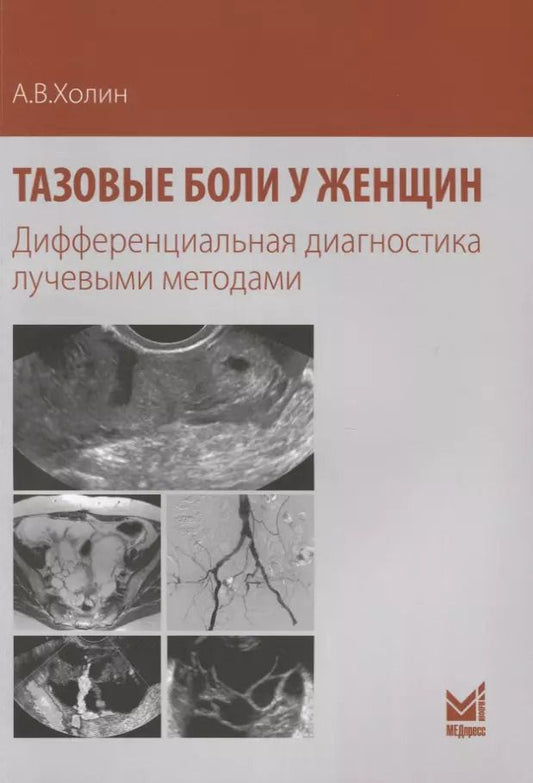 Обложка книги "Александр Холин: Тазовые боли у женщин Дифференциальная диагностика лучевыми методами (м) Холин"