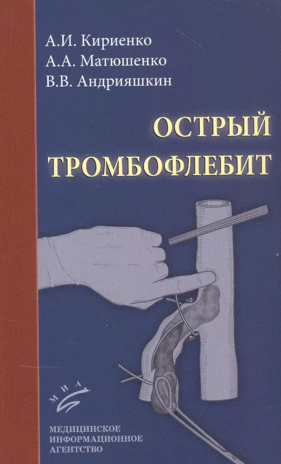 Обложка книги "Александр Кириенко: Острый тромбофлебит"