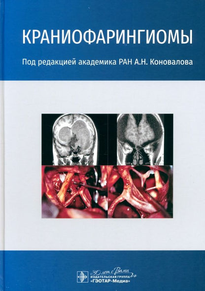 Обложка книги "Александр Коновалов: Краниофарингиомы"