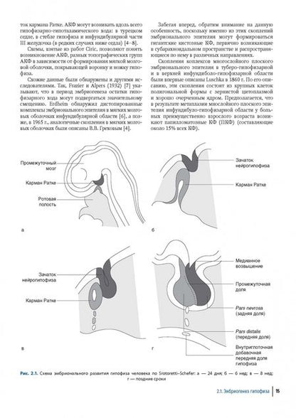 Фотография книги "Александр Коновалов: Краниофарингиомы"