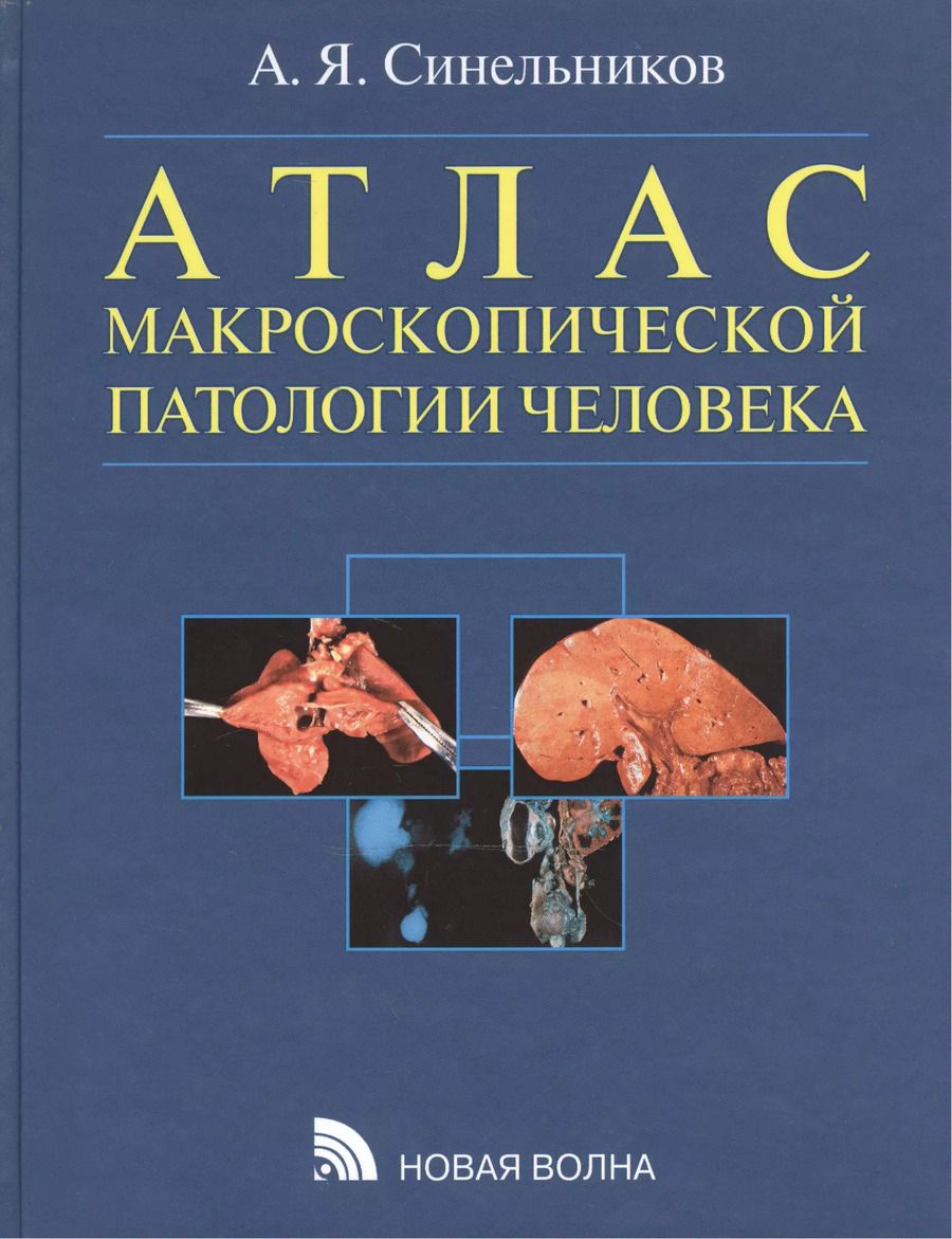 Обложка книги "Александр Синельников: Атлас макроскопической патологии человека: учебное пособие"