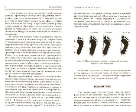 Фотография книги "Александра Васильева: Плоскостопие. Самые эффективные методы лечения"