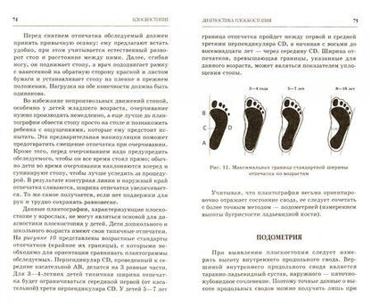 Фотография книги "Александра Васильева: Плоскостопие. Самые эффективные методы лечения"