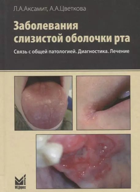 Обложка книги "Александровна, Анатольевна: Заболевания слизистой оболочки рта. Связь с общей патологией. Диагностика. Лечение. 2-е изд."