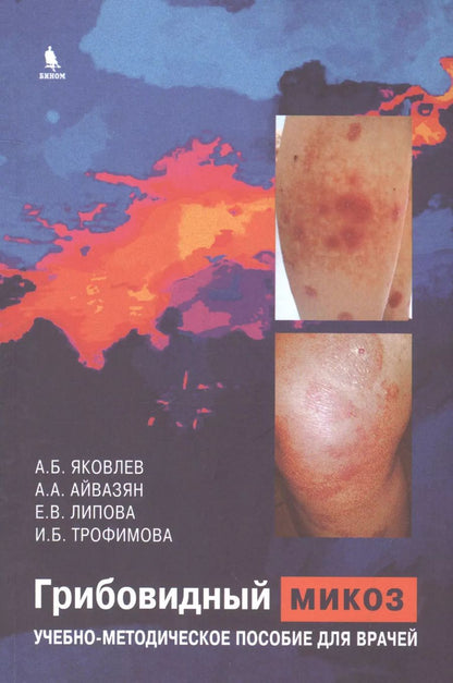 Обложка книги "Алексей Яковлев: Грибовидный микоз. Учебно-методическое пособие для врачей"