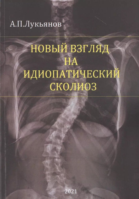 Обложка книги "Андрей Лукьянов: Новый взгляд на идиопатический сколиоз"