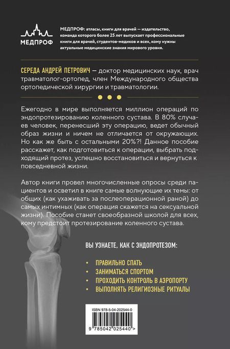 Фотография книги "Андрей Середа: Эндопротезирование коленного сустава: ответы практикующего врача на все вопросы пациентов"