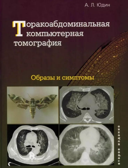 Обложка книги "Андрей Юдин: Торакоабдоминальная компьютерная томография. Образы и симптомы"
