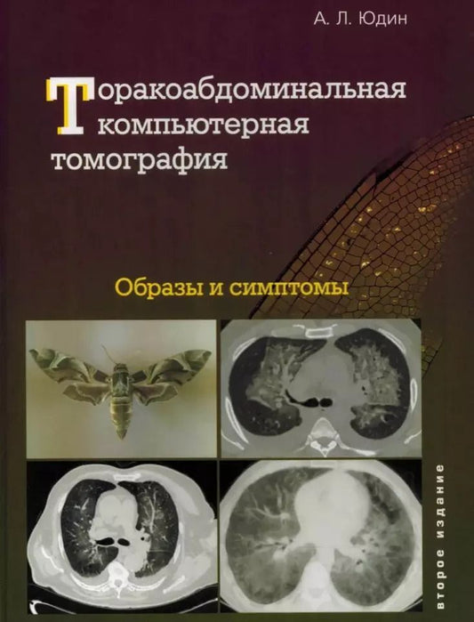 Обложка книги "Андрей Юдин: Торакоабдоминальная компьютерная томография. Образы и симптомы"