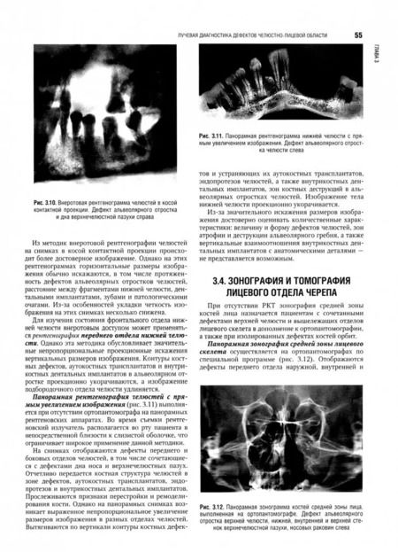 Фотография книги "Аржанцев, Абрамян, Арутюнов: Челюстно-лицевая хирургия. Национальное руководство"