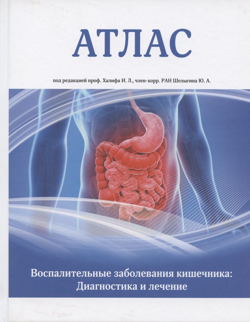 Обложка книги "Атлас. Воспалительные заболевания кишечника. Диагностика и лечение"