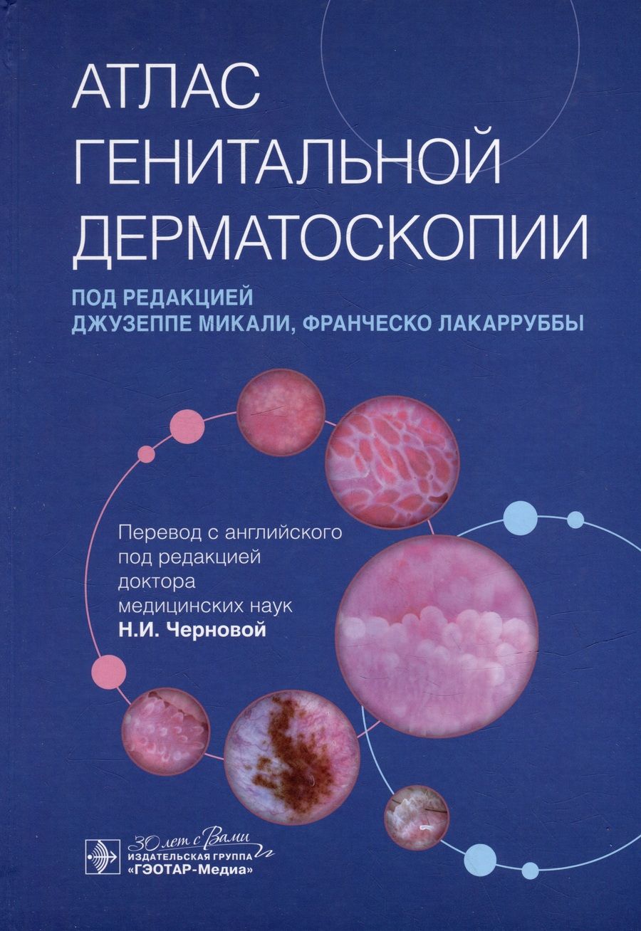 Обложка книги "Атлас генитальной дерматоскопии. Руководство"