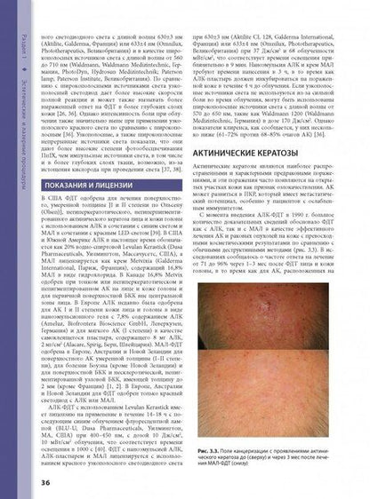 Фотография книги "Аврам, Аврам, Ратнер: Процедуры в дерматологии. Клиническая косметология"