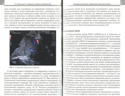 Фотография книги "Бабенко, Зазерская, Антошина: Акушерство и гинекология в ФГБУ "НМИЦ им. В.А. Алмазова""