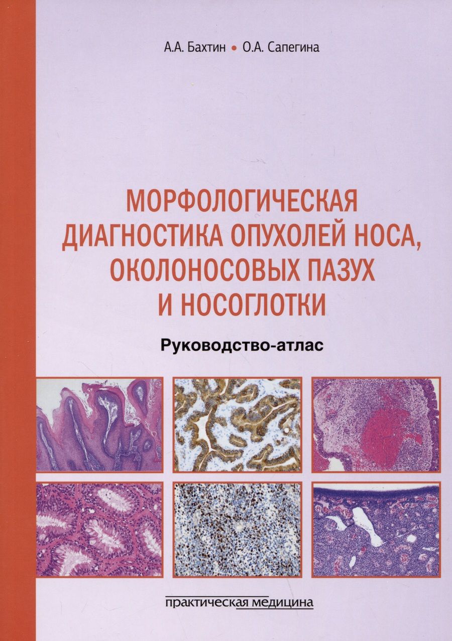 Обложка книги "Бахтин, Сапегина: Морфологическая диагностика опухолей носа, околоносовых пазух и носоглотки. Руководство-атлас"