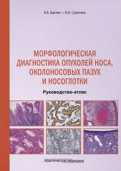 Обложка книги "Бахтин, Сапегина: Морфологическая диагностика опухолей носа, околоносовых пазух и носоглотки. Руководство-атлас"