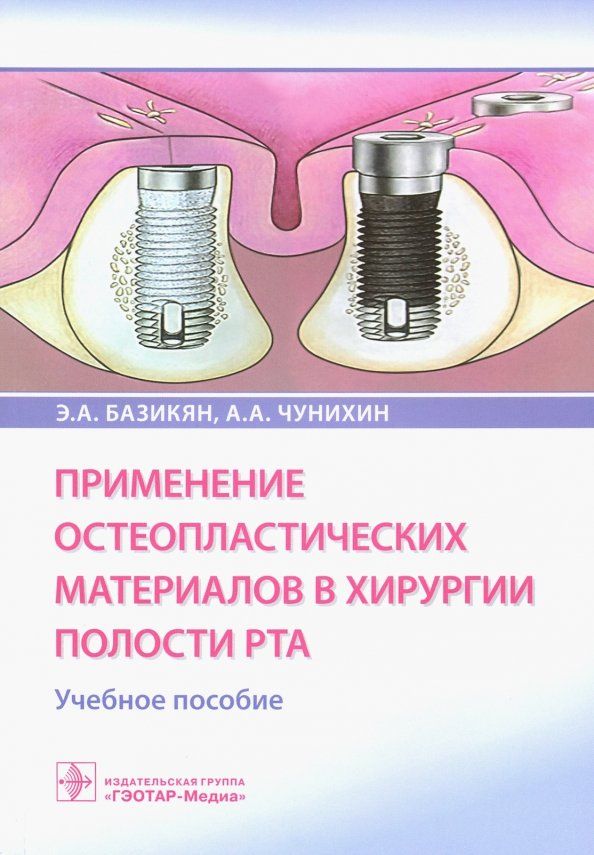 Обложка книги "Базикян, Чунихин: Применение остеопластических материалов в хирургии полости рта"