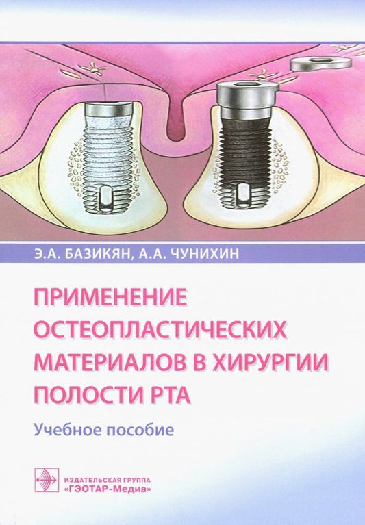 Обложка книги "Базикян, Чунихин: Применение остеопластических материалов в хирургии полости рта"