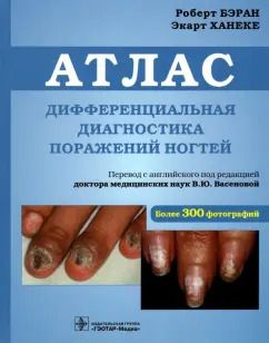 Обложка книги "Бэран, Ханеке: Дифференциальная диагностика поражений ногтей. Атлас"