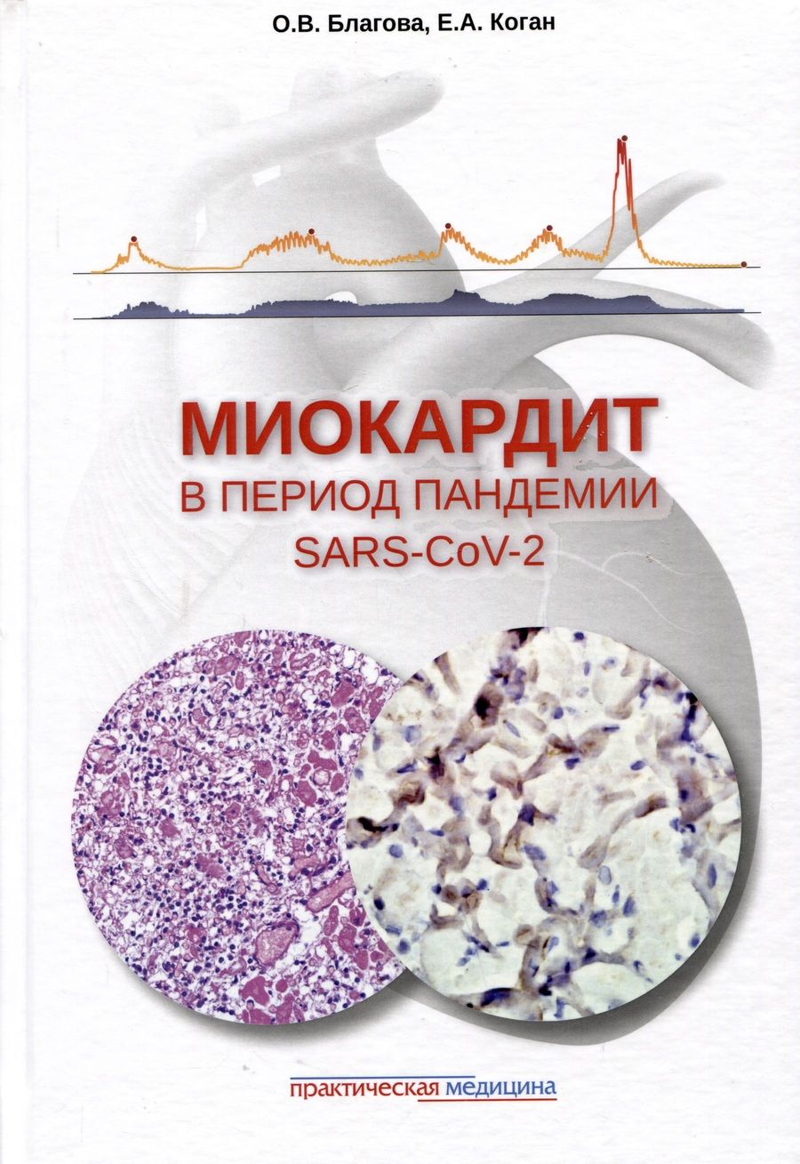 Обложка книги "Благова, Коган: Миокардит в период пандемии SARS-CoV-2"