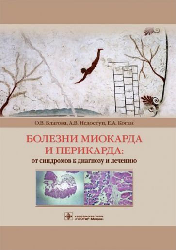 Обложка книги "Благова, Недоступ, Заклязьминская: Болезни миокарда и перикарда. От синдромов к диагнозу и лечению"