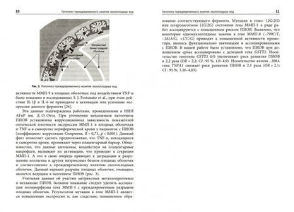 Фотография книги "Болотских, Рухляда, Афанасьева: Преждевременное излитие околоплодных вод. Этиология, патогенез, диагностика, тактика ведения берем."