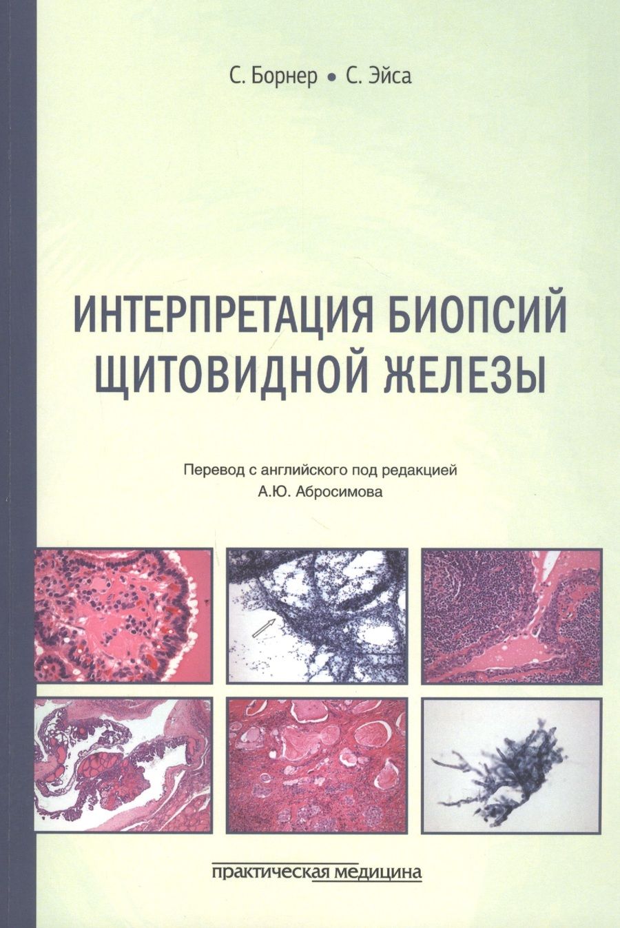 Обложка книги "Борнер, Эйса: Интерпретация биопсий щитовидной железы"