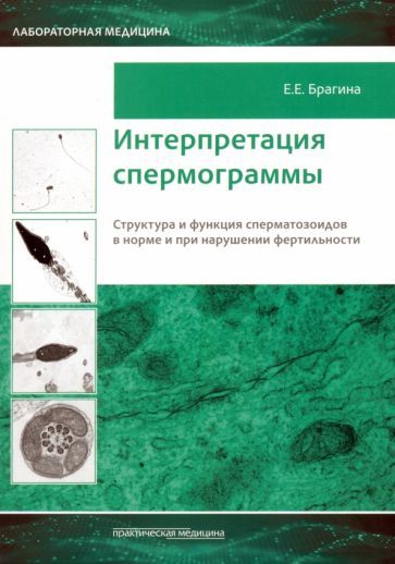 Обложка книги "Брагина: Интерпретация спермограммы. Структура и функция сперматозоидов в норме и при нарушении фертильности"
