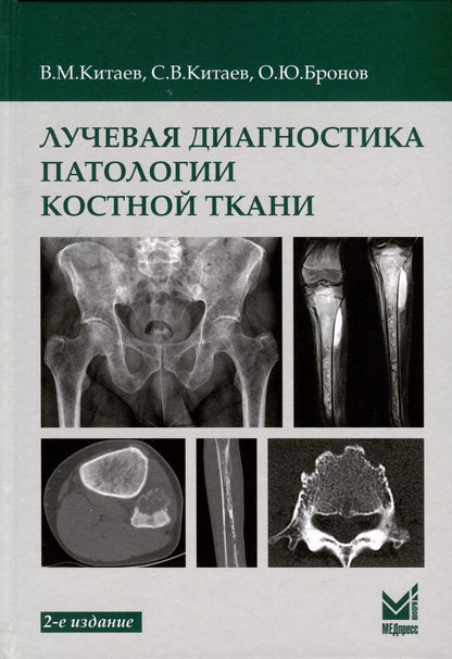 Обложка книги "Бронов, Китаев, Китаев: Лучевая диагностика патологии костной ткани"