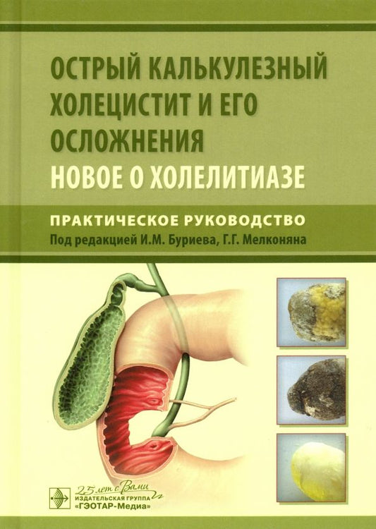 Обложка книги "Буриев, Мелконян, Веденина: Острый калькулезный холецистит и его осложнения. Новое о холелитиазе. Практическое руководство"