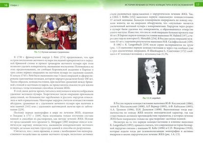Фотография книги "Буриев, Мелконян, Веденина: Острый калькулезный холецистит и его осложнения. Новое о холелитиазе. Практическое руководство"