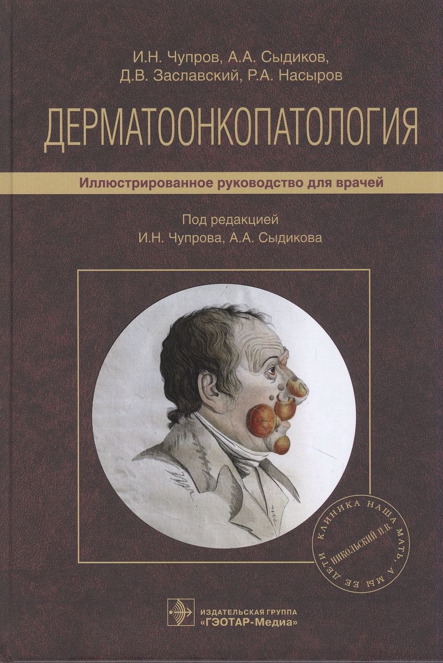 Обложка книги "Чупров, Сыдиков, Заславский: Дерматоонкопатология. Руководство"