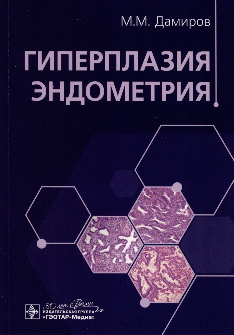 Обложка книги "Дамиров, Олейникова, Шабанов: Гиперплазия эндометрия"