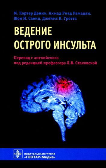 Обложка книги "Денни, Рамадан, Савиц: Ведение острого инсульта"
