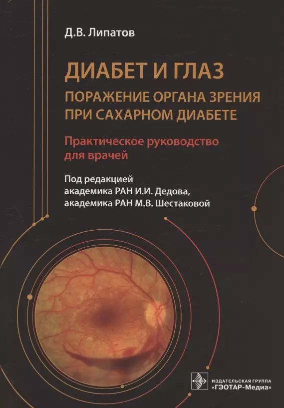 Обложка книги "Дмитрий Липатов: Диабет и глаз. Поражение органа зрения при сахарном диабете"