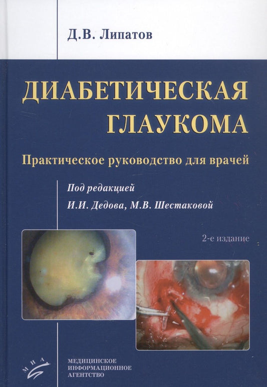 Обложка книги "Дмитрий Липатов: Диабетическая глаукома: Практическое руководство для врачей"