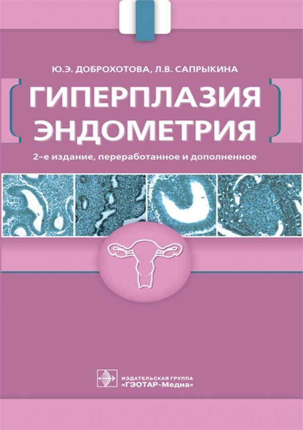 Обложка книги "Доброхотова, Сапрыкина: Гиперплазия эндометрия"