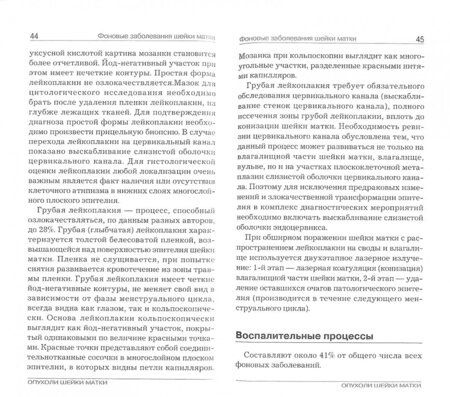 Фотография книги "Доброхотова, Венедиктова, Морозова: Опухоли шейки матки"
