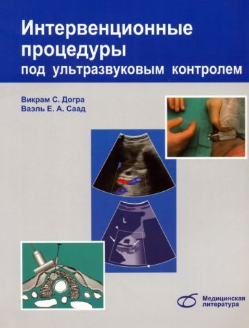 Обложка книги "Догра, Монзер, Браун: Интервенционные процедуры под ультразвуковым контролем"