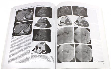 Фотография книги "Догра, Монзер, Браун: Интервенционные процедуры под ультразвуковым контролем"