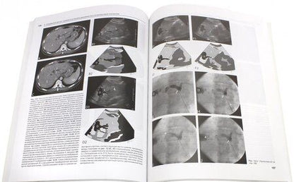 Фотография книги "Догра, Монзер, Браун: Интервенционные процедуры под ультразвуковым контролем"