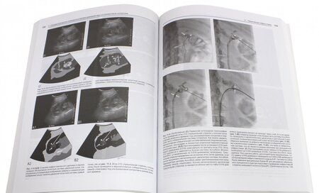 Фотография книги "Догра, Монзер, Браун: Интервенционные процедуры под ультразвуковым контролем"