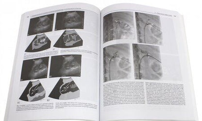Фотография книги "Догра, Монзер, Браун: Интервенционные процедуры под ультразвуковым контролем"