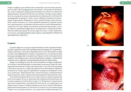 Фотография книги "Долинак, Матшес, Лью: Судебно-медицинская экспертиза трупа. Том 2"