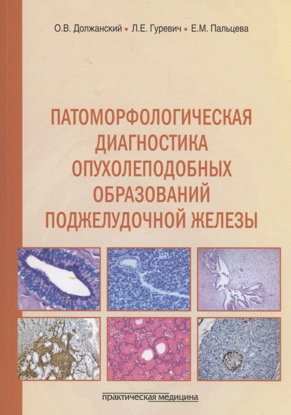 Обложка книги "Должанский, Пальцева, Гуревич: Патоморфологическая диагностика опухолеподобных образований поджелудочной железы. Руководство"