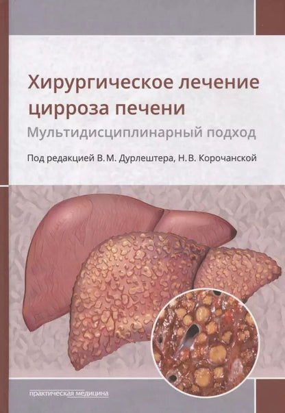 Обложка книги "Дурлештер, Корочанская, Габриэль: Хирургическое лечение цирроза печени. Мультидисциплинарный подход. Монография"