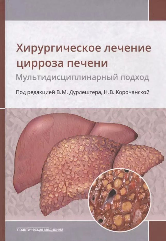 Обложка книги "Дурлештер, Корочанская, Габриэль: Хирургическое лечение цирроза печени. Мультидисциплинарный подход. Монография"