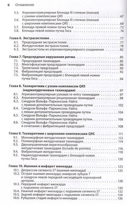 Фотография книги "Джеймс, Нельсон: Карманный справочник по ЭКГ"