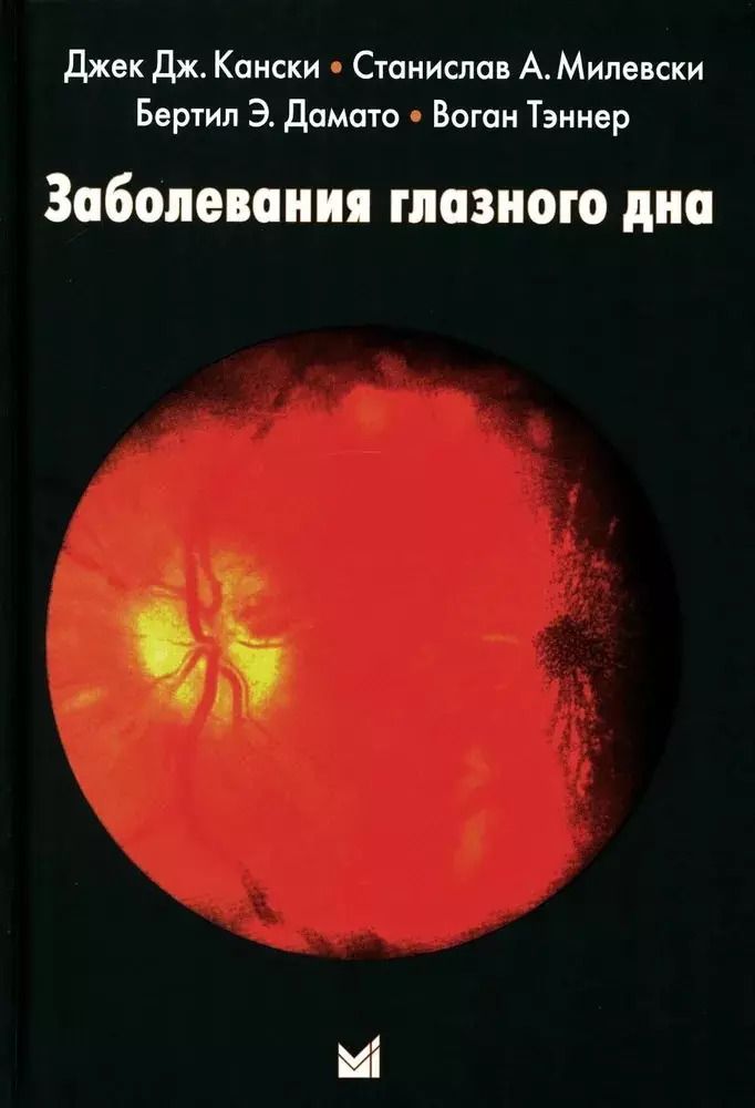 Обложка книги "Джек Дж.: Заболевания глазного дна"